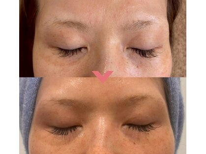 シエルビューティークロップ(Ciel Beauty CROP)の写真