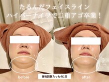クロレ 浦和店(CLORE)の雰囲気（フォトにbefore&after・口コミを多数掲載しております◎）