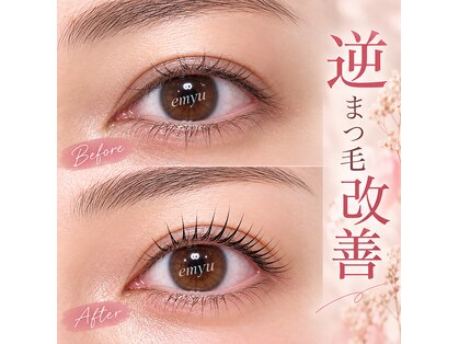 エミュー(emyu)の写真