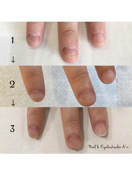 ネイルアンドアイラッシュ アヴィ(Nail and Eyelash A'vi)/自爪育成３回コース