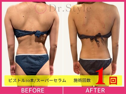 痩身エステ 美容整体 ドクタースタイル(Dr.Style)の写真