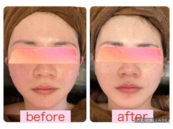 ベルフルールエム(Belle Fleur.M)/幹細胞でお肌のハリと潤いアップ