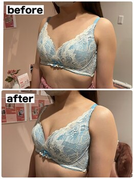 マイントゥー(mine too)/