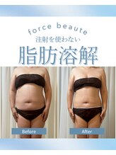 フォルスボーテ(Force Beaute) 脂肪 分解