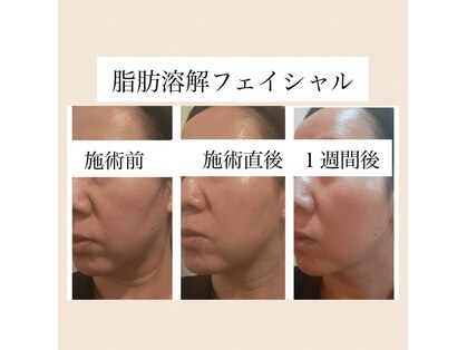 エステサロン カラーズ(COLORS)の写真