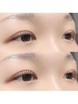 ルース(Lus)/Lashlift 上