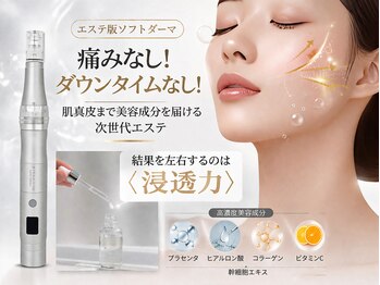 トータルエステサロン エステアンドメイク 錦糸町/最新美容/ソフトダーマ☆ペン