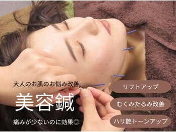 本多鍼灸整骨院の写真/《顔も身体も同時に贅沢ケア》肌悩みを解決する美容鍼×全身鍼灸で、内側から輝く美と健康へ◎リピート続出