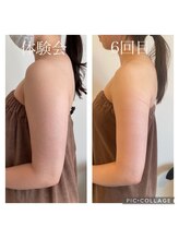 オードリリー(eau de Lily)/ブライダルの方にも大人気！