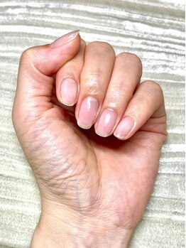 深爪専門ラボの写真/【お手入れだけでも手元が変わる！】健康的な爪の育成にはケアが重要！コンプレックスを改善し美しい指先へ