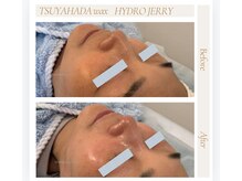 アリー(ALLY)/艶肌wax