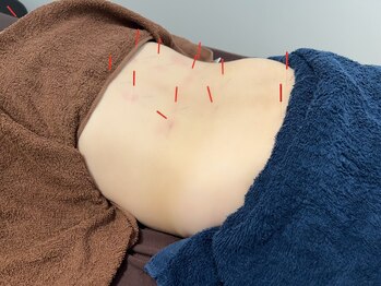 トイ鍼灸接骨院(TOY鍼灸接骨院)/●マタニティ