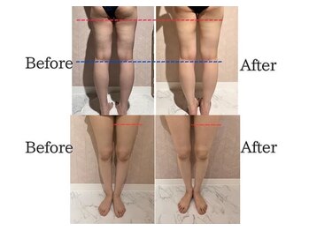 ミューズファクトリー(Muse factory)/気になるむくみに効果的！