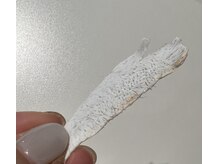 ルポ 祖師ヶ谷大蔵(repos)/眉の間をWAX脱毛