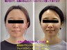 【小顔】顔たるみケア/ほうれい線撃退&スッキリ美人！小顔矯正コース初回体験