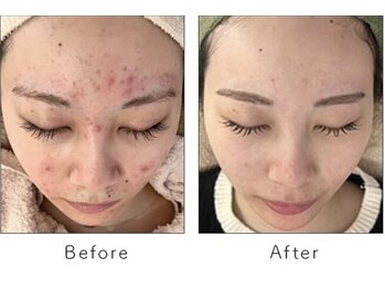 アトリエリン 小牧本店(Atelier Rin)/ララピール×ハイドラ