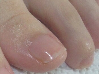 フットケアアンドネイルサロン エピス(epices)の写真/【フットケアに特化したサロン★】２枚爪やガサガサのかかとをつるんと潤いあふれるふわふわな足裏へ◎