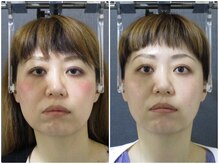 顔と身体の歪み矯正院 吉祥寺の雰囲気（ビフォーアフター）