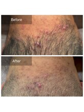 エヌア(nA)/ビフォーアフターコモデックス！