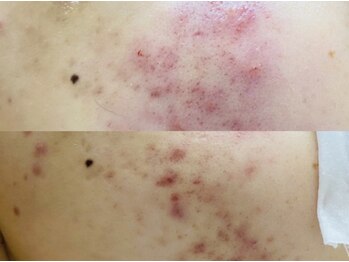 スロー(Slow)/深刻なお肌悩みもお任せ下さい