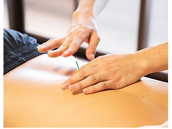 【メンズ専門】鍼/整体/脱毛/毛穴ケア Emotion plus【エモーションプラス】の写真/疲れにくく回復できる身体へ導くメンズ専門店★ボディケア＋マッサージ＋頭皮鍼の回復フルSETがおすすめ!!