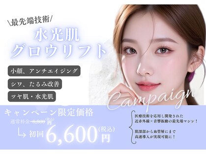 ナヴィ(NAVI)の写真