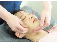 白記漢方堂鍼灸院(HAKU KI)/眼精疲労に目まわりの鍼灸