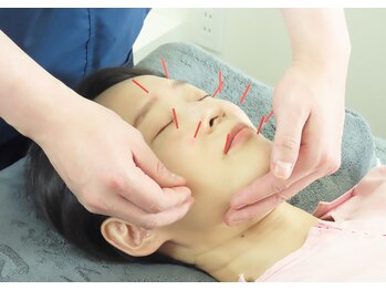 白記漢方堂鍼灸院(HAKU KI)/眼精疲労に目まわりの鍼灸