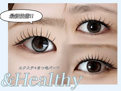 アリー 福井市西方(ALLY)の写真