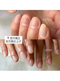 【深爪矯正】自爪風マット仕上げ