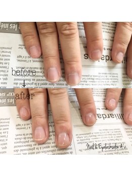 ネイルアンドアイラッシュ アヴィ(Nail and Eyelash A'vi)/爪周りの乾燥がきになる方に☆