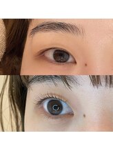 エン(EN)/ビフォーアフター