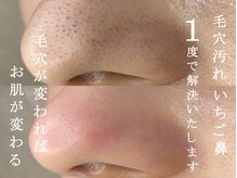 グロウアップ ビューティ 丸の内店(Glow-up Beauty)