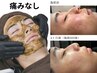 【肌ケア】全顔ハーブピーリング＋保湿マスク ¥9900