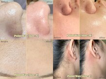 角栓や角質、産毛をケアしてあげるとトーンアップ＋化粧ノリUP◎