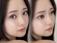 ミシェリ(MICHERIE)