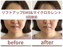 サボラミ(sabor A Mi)/EMS&マイクロカレント