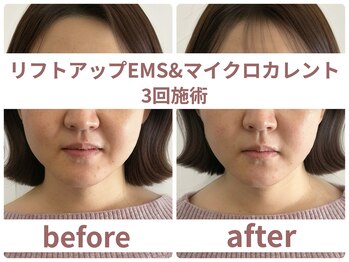 サボラミ(sabor A Mi)/EMS&マイクロカレント