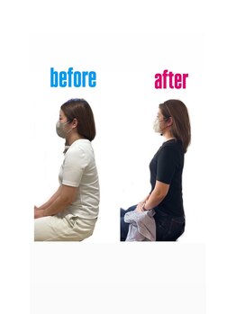 スマイル整骨院 八代院/猫背の効果