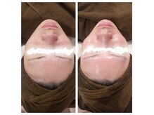 チル アウト(CHILL OUT)の雰囲気（うっとり♪つやんつやんのお肌へ導きます！）