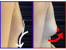 セブンシーズ 上野店(Seven Seas)/バストアップ/豊胸/東京都/上野