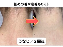 NTエステティック 西条店の雰囲気（丁寧な施術で、たしかな効果♪）