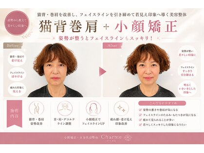 シャルム(Charme)の写真