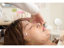 マーキュリー(Mercury)/美容鍼灸