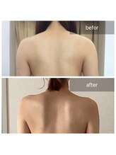 ナツコ 福島(natsuko)/肩幅スッキリ！