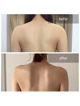 ナツコ 福島(natsuko)/肩幅スッキリ！