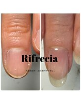 リフレシア(Rifrecia)/爪の形にお悩みのお客様