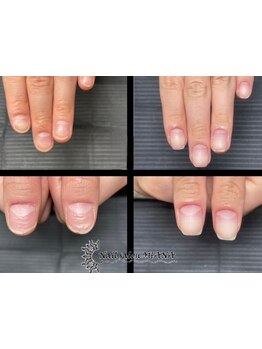 爪の悩みを解消できる（ケア含む）