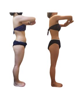 ナリジム 赤坂/4カ月-14kg(身長158cm47キロ