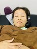【メイクノリUP】美容鍼でフェイスラインすっきり☆小顔効果◎トーンアップも